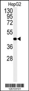 Anti-NR5A1 Rabbit Polyclonal Antibody