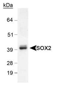 Anti-SOX2 Rabbit Polyclonal Antibody