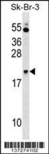 Anti-NKIRAS1 Rabbit Polyclonal Antibody (Biotin)
