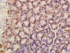 Immunohistochemical staining of rat colon tissue using Caspase 14 antibody.