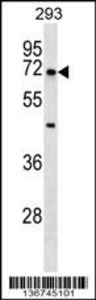Anti-NR5A2 Rabbit Polyclonal Antibody (HRP (Horseradish Peroxidase))
