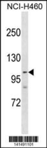 Anti-PARP1 Rabbit Polyclonal Antibody (HRP (Horseradish Peroxidase))