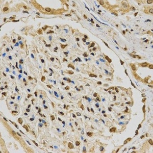 IHC-P staining of human kidney tissue using HNRNPA2B1 antibody (primary antibody dilution at 1:200)