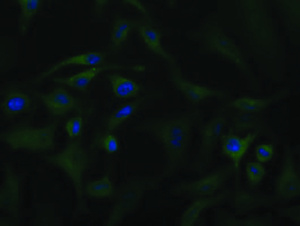 Anti-ACAT2 Mouse Monoclonal Antibody [clone: OTI1C5]