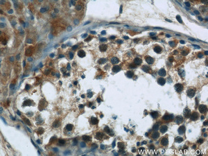 Anti-ARID4B Rabbit Polyclonal Antibody