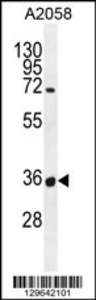 Anti-OR7G1 Rabbit Polyclonal Antibody (APC (Allophycocyanin))