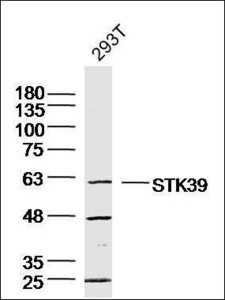 Western blot analysis of human 293T cell Lysate using PASK antibody.
