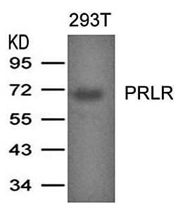 Western blot analysis of PRLR antibody in 293T cells lysates