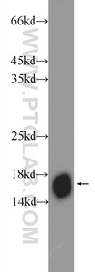 Anti-NDUFB5 Rabbit Polyclonal Antibody