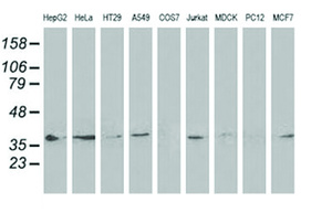 Anti-DNAJB1 Mouse Monoclonal Antibody [clone: OTI1F9]