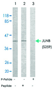 Anti-JUNB Rabbit Polyclonal Antibody