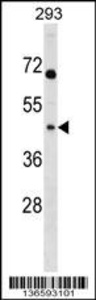 Anti-MRPL39 Rabbit Polyclonal Antibody (AP (Alkaline Phosphatase))