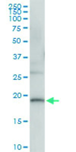 Anti-DUSP22 Polyclonal Antibody Pair
