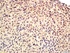 Immunohistochemical staining of Mouse ovary tissue using NRG1 antibody.