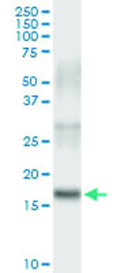 Anti-PLA2G16 Polyclonal Antibody Pair