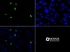 Anti-NF1 Mouse Monoclonal Antibody [clone: McNFn27a]