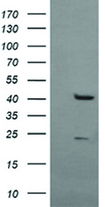 Anti-MSI1 Mouse Monoclonal Antibody [clone: OTI3C2]