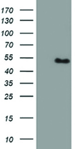 Anti-PBX1 Mouse Monoclonal Antibody [clone: OTI1H5]