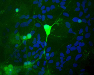 Image shows rat mixed neuron/glial cultures stained with BSENR-1408-50. Note that the Ubiquitin C Terminal Hydrolase 1 (UCHL1) antibody stains neurons strongly and specifically, and that the staining is concentrated in the cell bodies, though some does extend into the dendrites also.