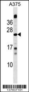 Anti-MBD3L1 Rabbit Polyclonal Antibody (HRP (Horseradish Peroxidase))