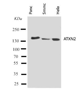 Anti-ATX2 Rabbit Polyclonal Antibody