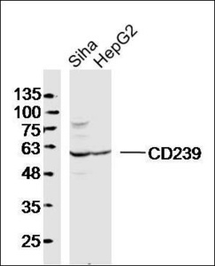 Western blot analysis of human Siha lysates (Lane 1), human HepG2 lysates (Lane 2), mouse Lung lysates (Lane 3) using CD239 antibody.
