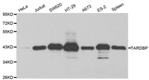 Western blot analysis of extracts of various cell lines using TARDBP antibody