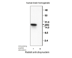 Western Immunoblotting of human b-synuclein protein in human brain homogenate, 10 µg protein per lane. Crude anti-beta-synuclein ab (Catalog Number BSENR-1683-100) used at 1:1000.Peptide absorption reduced antibody reactivity for expected beta-synuclein band of 17 kDa.