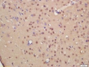 Immunohistochemical staining of rat brain tissue using NRG1 antibody.