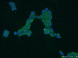 Anti-ZDHHC13 Rabbit Polyclonal Antibody