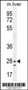 Anti-NIPSNAP3B Rabbit Polyclonal Antibody (AP (Alkaline Phosphatase))