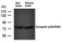Western blot analysis of Synapsin(phospho-Ser549) antibody in rat brain and mouse brain tissue lysates
