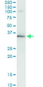Anti-WBSCR22 Antibody Pair