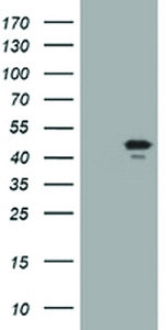 Anti-TRIM44 Mouse Monoclonal Antibody [clone: OTI4A5]
