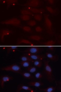 Immunofluorescense analysis of U2OS cell using KPNA1 antibody