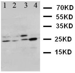 Anti-Bcl10 Rabbit Polyclonal Antibody