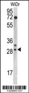 Anti-MRPL9 Rabbit Polyclonal Antibody (HRP (Horseradish Peroxidase))
