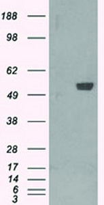 Anti-PFKFB4 Mouse Monoclonal Antibody [clone: OTI1C8]