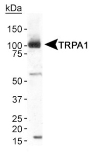 Anti-TRPA1 Rabbit Polyclonal Antibody