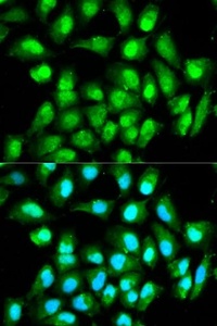Immunofluorescense analysis of HeLa cell using RAN antibody