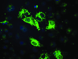 Anti-BCKDK Mouse Monoclonal Antibody [clone: OTI11C9]
