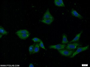 Anti-SEC61A Rabbit Polyclonal Antibody