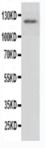Anti-Myeloperoxidase Rabbit Polyclonal Antibody