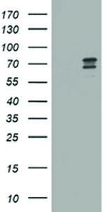 Anti-RIOK2 Mouse Monoclonal Antibody [clone: OTI2F4]