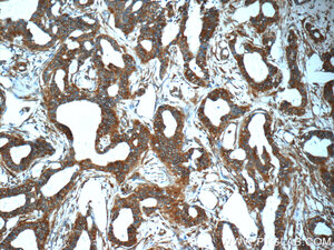 Anti-SCGB2A2 Rabbit Polyclonal Antibody