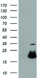 Anti-RBBP9 Mouse Monoclonal Antibody [clone: OTI2G2]