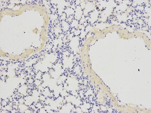 Immunohistochemical analysis of formalin-fixed and paraffin-embedded rat pancreas tissue using IL1RN antibody (primary antibody dilution at 1:200)