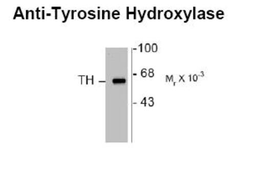 TYROSINE HYDROXYLASE ANTIBODY_50-262