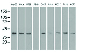 Anti-MAPK1 Mouse Monoclonal Antibody [clone: OTI6E5]