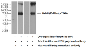 Anti-HYDIN Rabbit Polyclonal Antibody